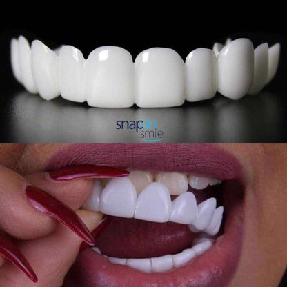 |SNAP ON SMILE| Diseño de Sonrisa INSTANTANEO de RESINA