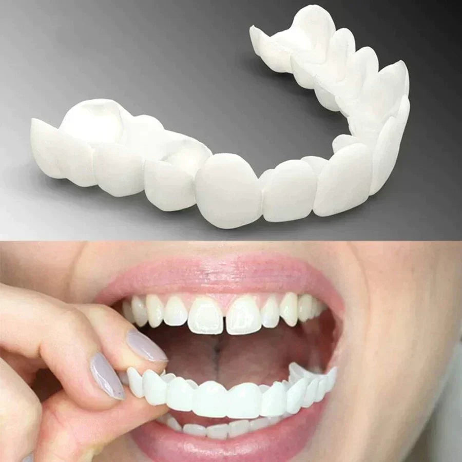 |SNAP ON SMILE| Diseño de Sonrisa INSTANTANEO de RESINA